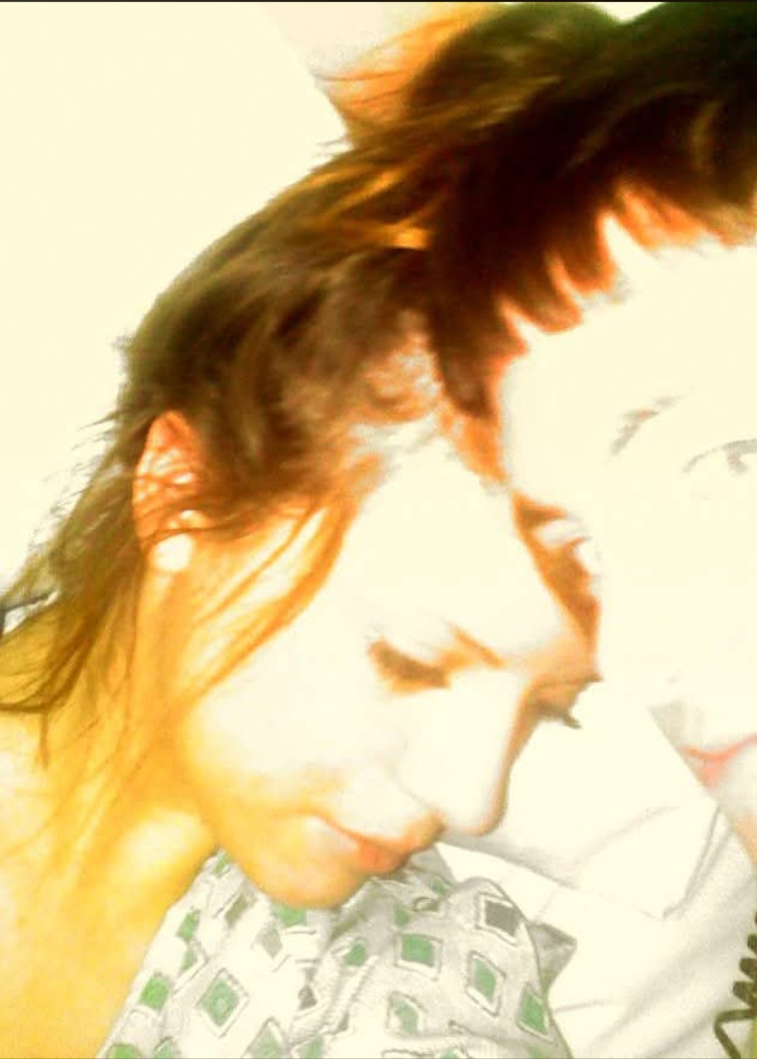 Original personal archive photograph from age 18 showing the aftermath of physical abuse